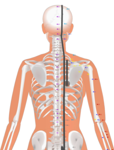 07 BL46 Geguan Diaphragm Gate膈關